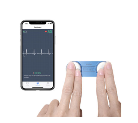ECG Monitor